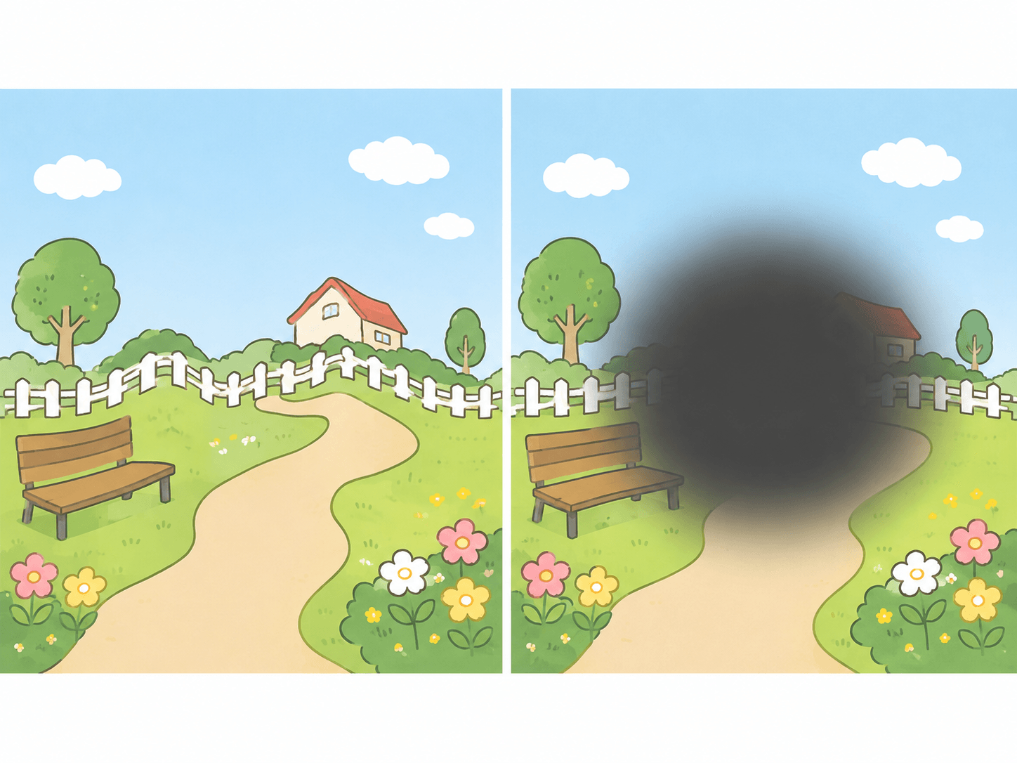 加齢黄斑変性による見え方の変化を示すイラスト
